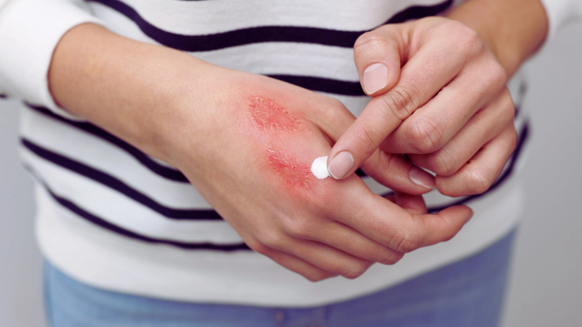 Slow Healing of Cuts or Sores