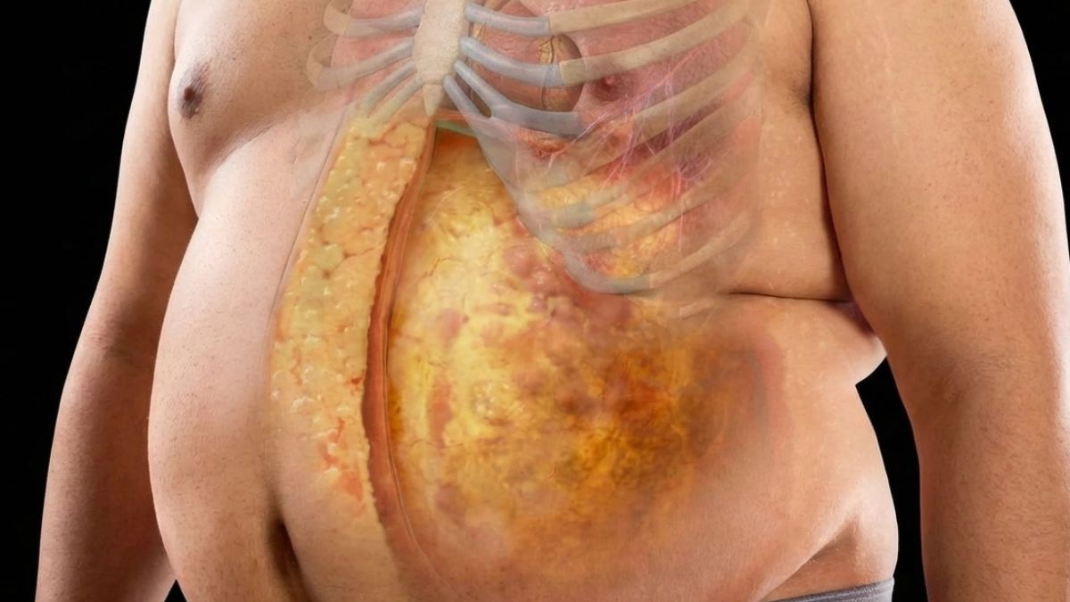 How to Actually Burn Off Belly Fat FAST—and Why It Matters