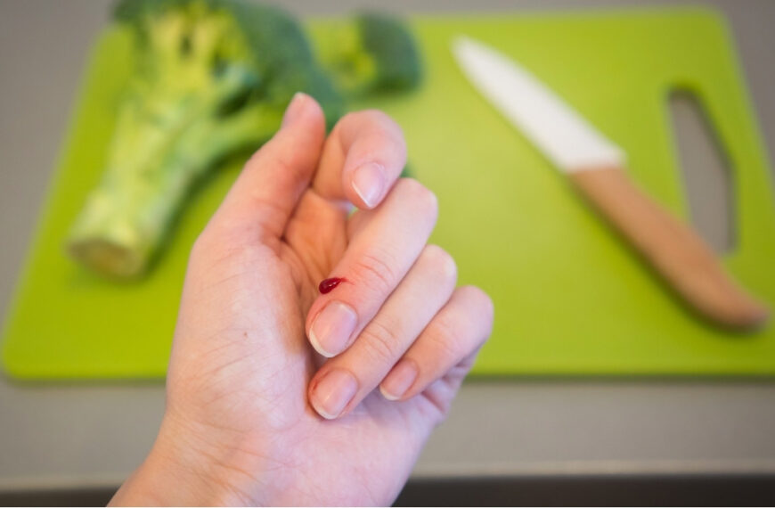 What Your Brittle Nails Are Revealing About Your Gut&hellip;