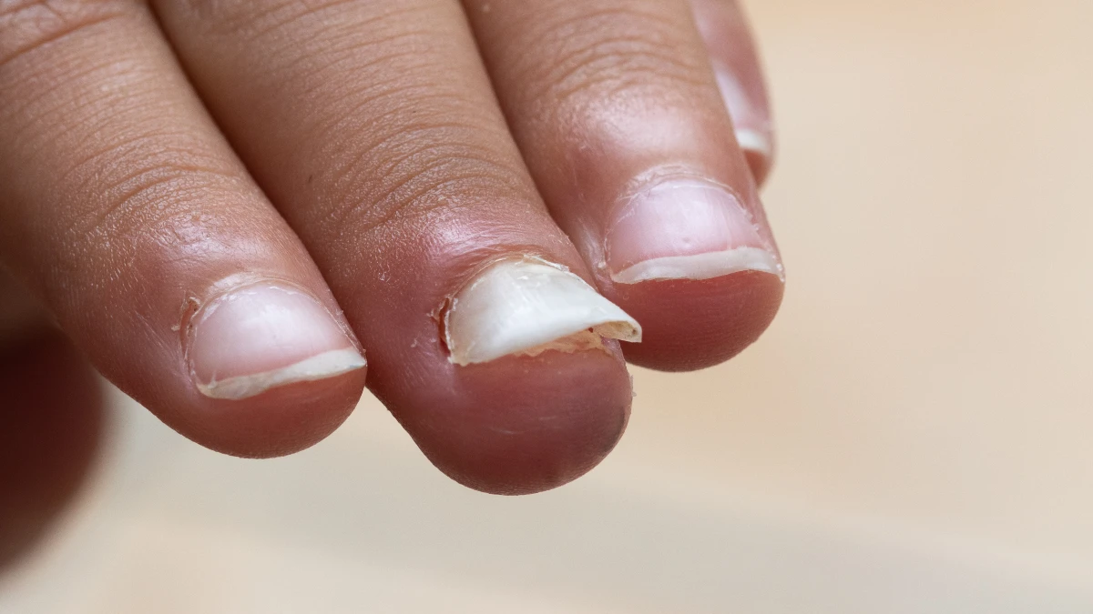 Your Nails Are Sending You a Message About Your Gut