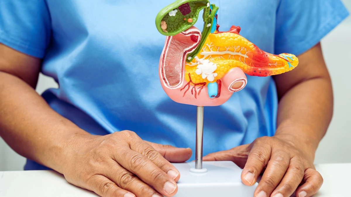 Pancreatic Cancer: Breaking Through the Toughest Barrier