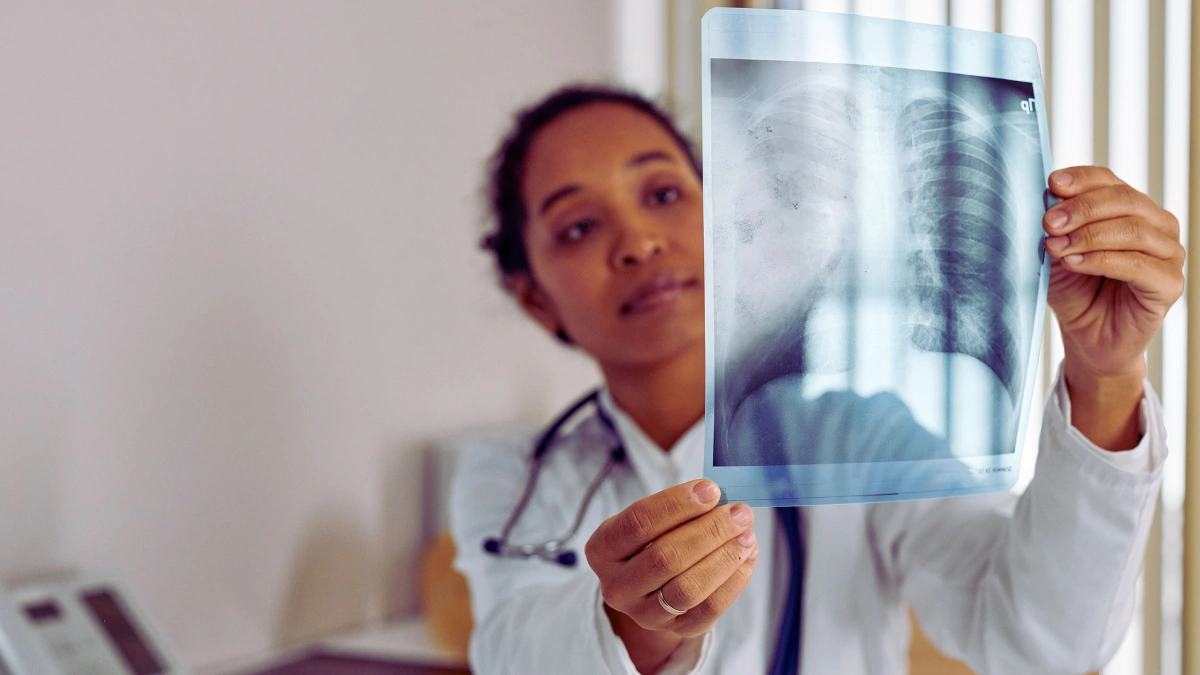 The Surprising Lung Cancer Discovery