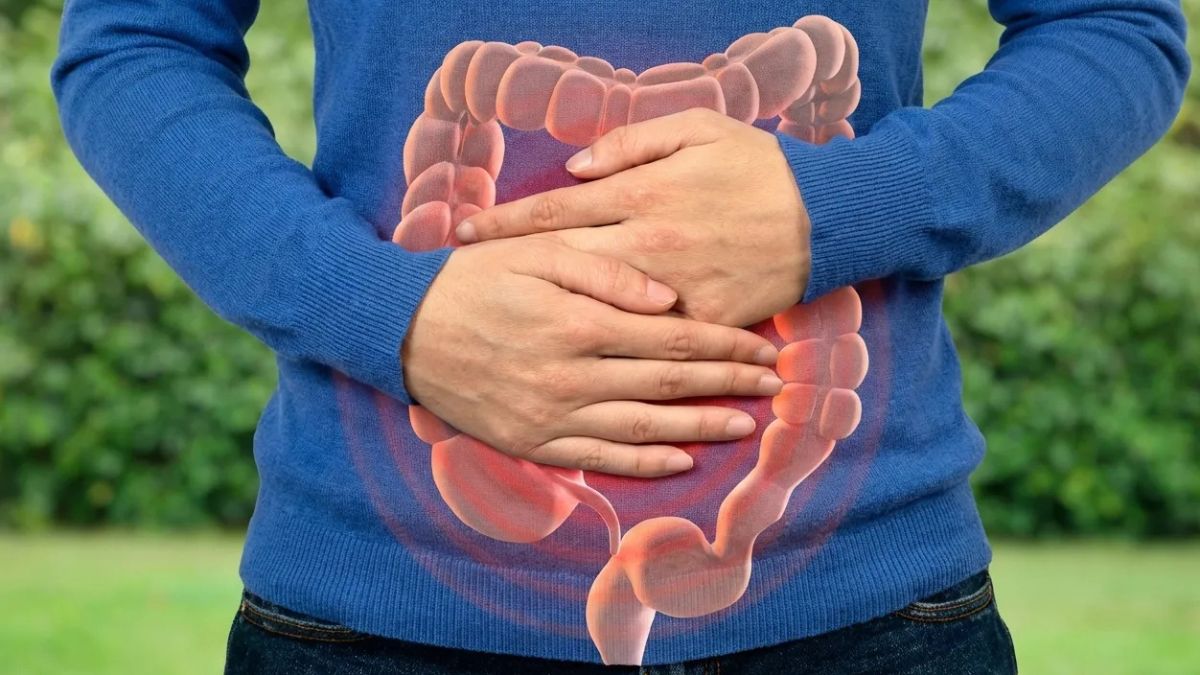 13 Gut-Healing Foods For IBS Relief — And 4 Triggers To Avoid, According To A Gastroenterologist