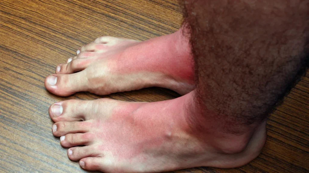 Cold Feet in a Warm Room