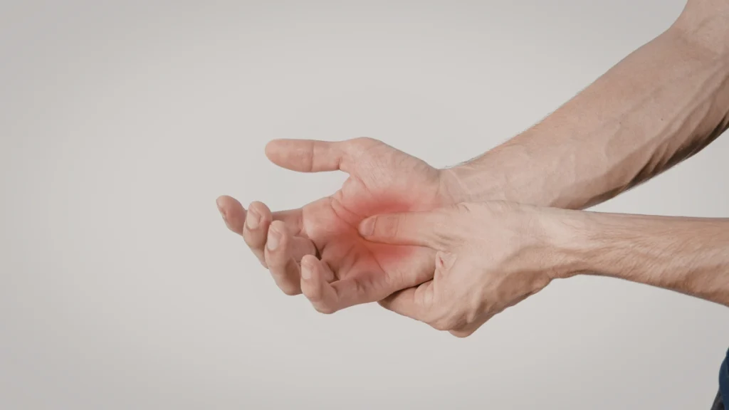 Palmar Erythema (Red Palms)