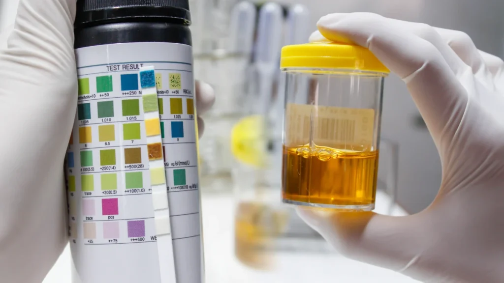 Dark Urine