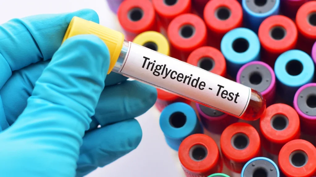 High Triglycerides