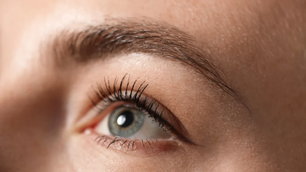 Loss of outer eyebrows