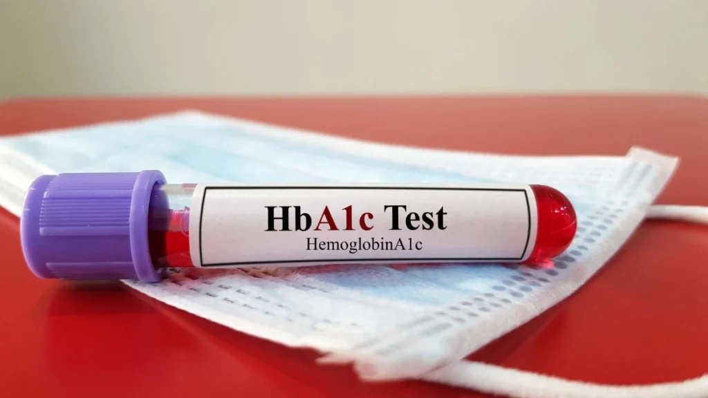 The A1C Test Is Convenient, but It Has Limits