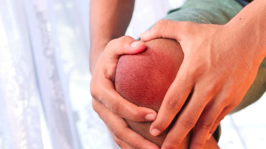 Knee damage is more complicated than simple wear