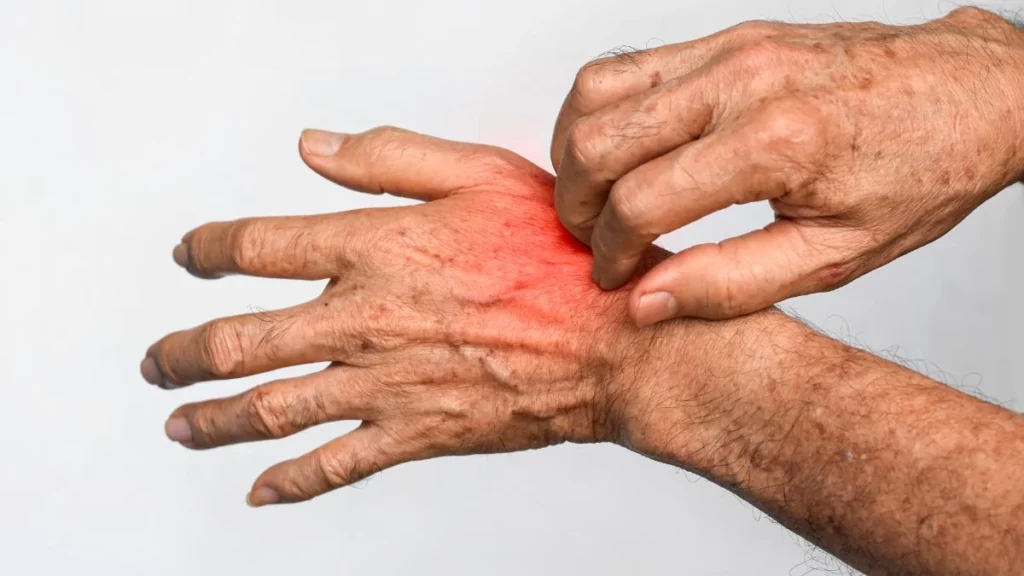 Undetected Fungal Skin Infections