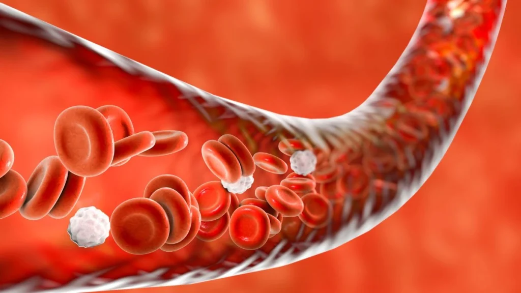 Blood Vessel Dilation Disorders