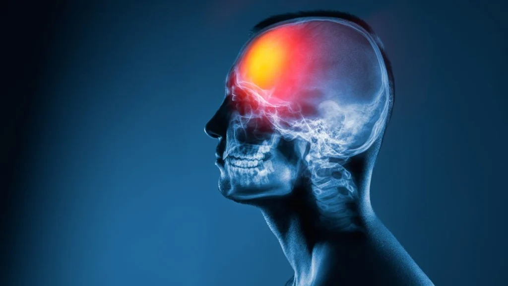 Head Injuries