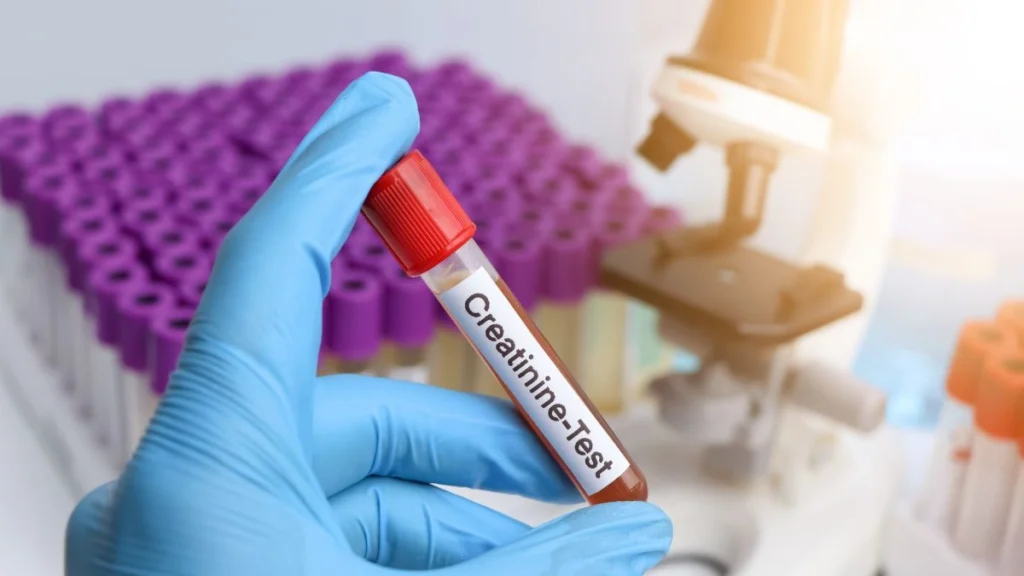 A Normal Creatinine Result May Not Tell the Whole Story