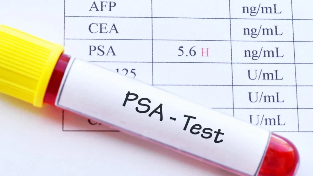 PSA test