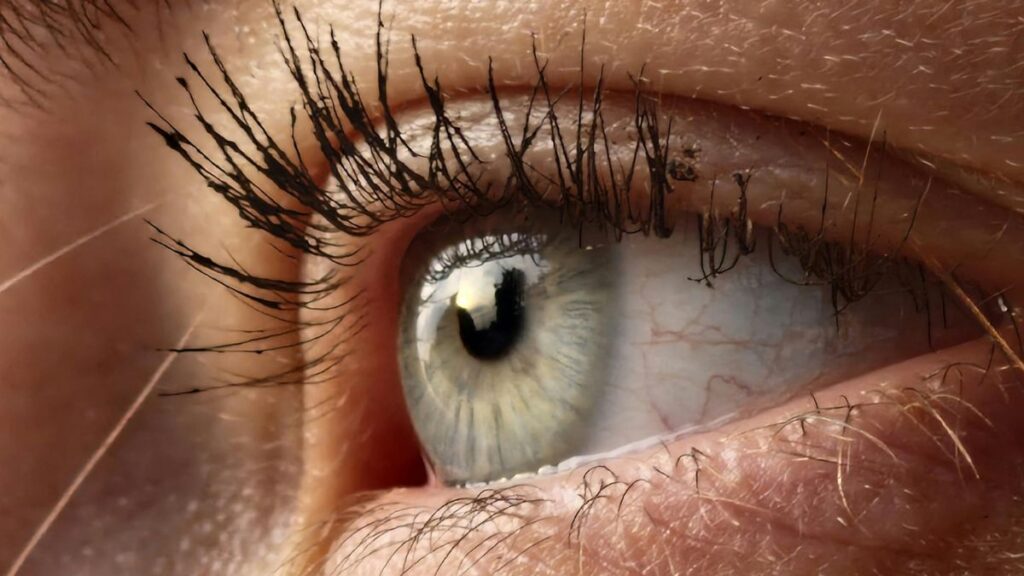 Macular Degeneration